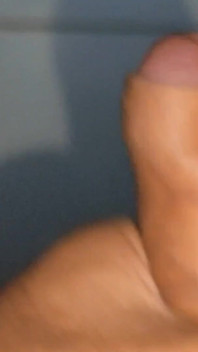 Large Deformed Cock with Lumpy Glans.
