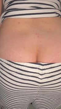 Farting in Pajamas Buttcrack
