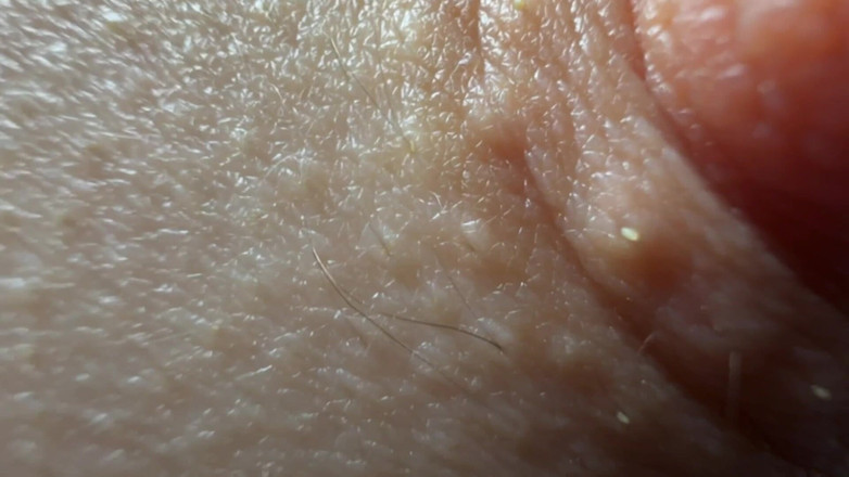 Skinny_lady69: Bradavky Pussy Asshole Feet zblízka