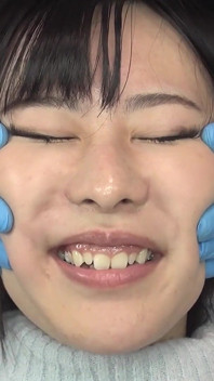 Yuki Makimura - kecacatan muka melampau, kawalan pancutan muka dan rakaman dekat