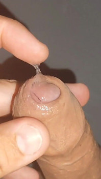 Método extremo de colar as glandes com super cola