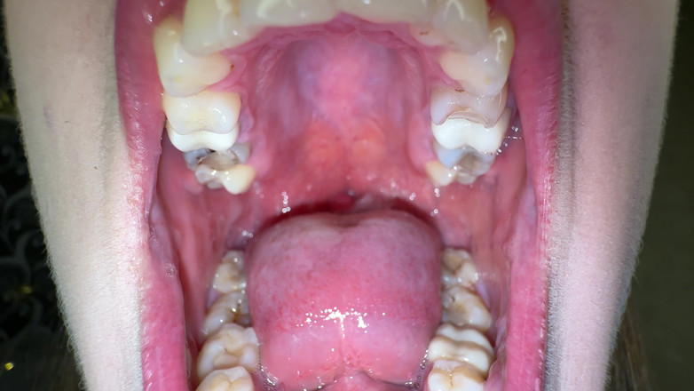 Hottie goddess: Halsfick-Schleimextraktion: ultimatives sabbern &amp; schleimspiel