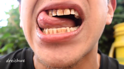 Dreichwe: Cioccolato sui denti