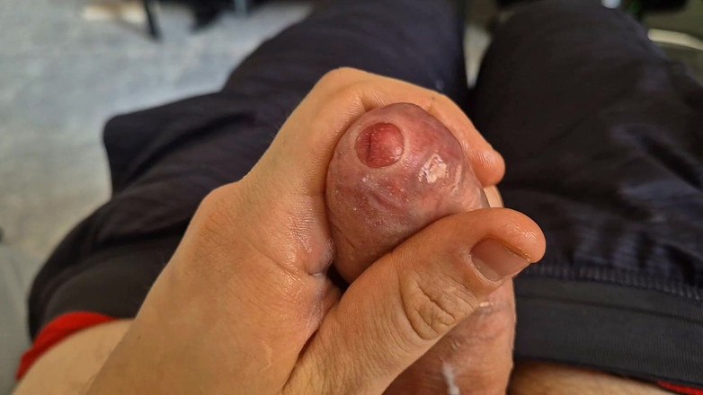 GloomyChase977: Fimoză, tati. Ight prepuț mângâie până când am scurgeri peste...
