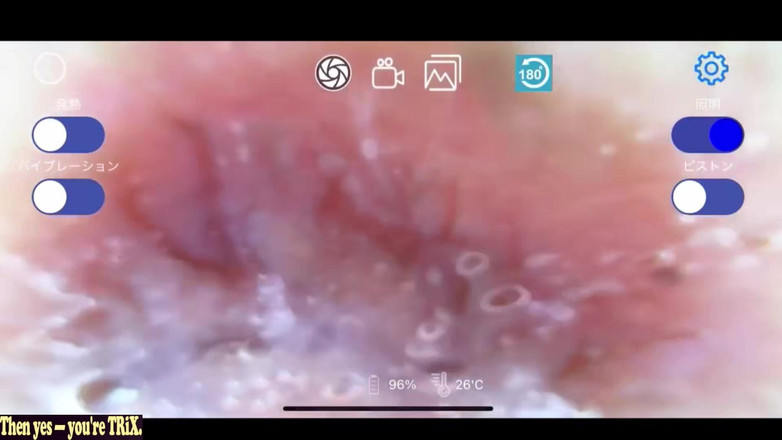 A case of fling: Asijský anděl 26559