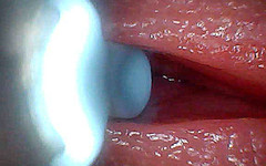 Creme sperm: Ich Konnte Nicht Glauben, Was Im Penis Passiert, Während Sperma...