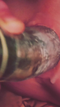 Dilatation Anal