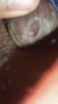 Super Anal