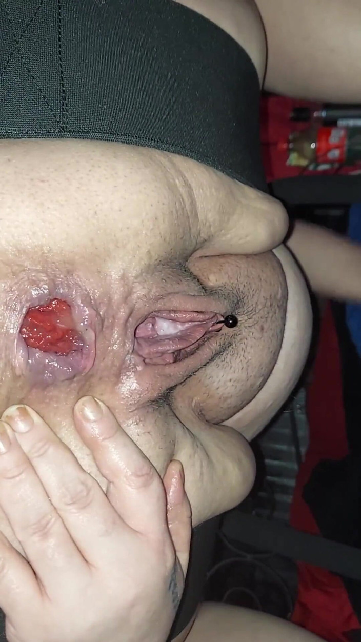 Anal_Angi_Rose: Bbc Toy Anal Prolapso