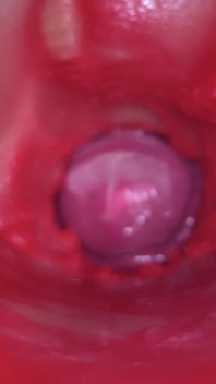 Camera Inside Pussy: Powerfull Cum in Pussy! Best Internal Asmr in 4K More Sperm
