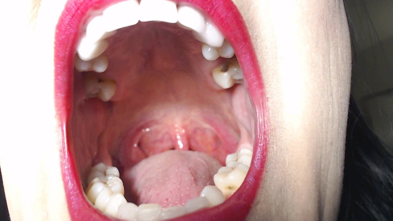 Abby Anna: Big wide open mouth
