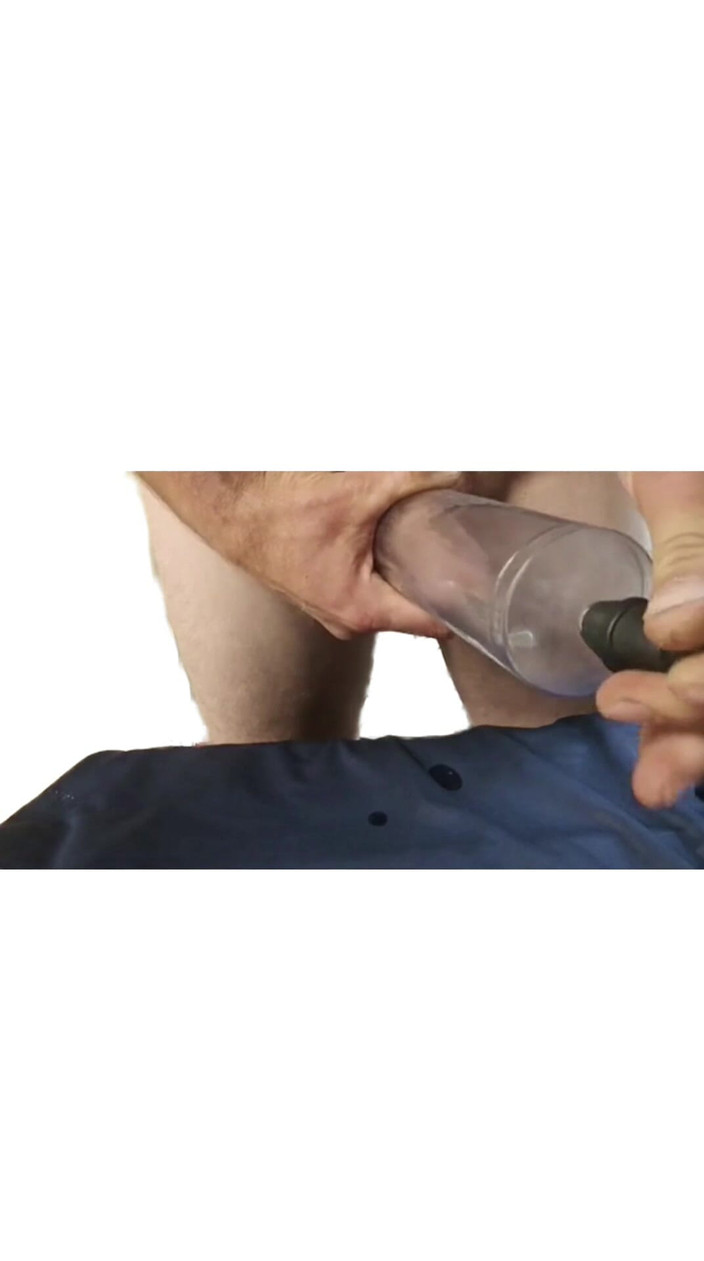Artbigd: Sonda uretrale e pompaggio