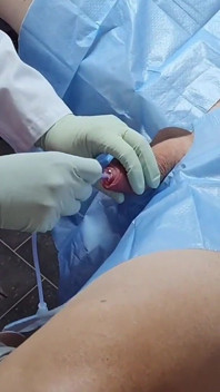 Hanna Engelss - Catheter in and Urine Out