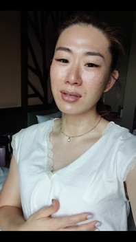Day 3 Post Op