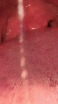Uvula