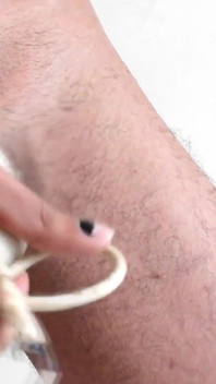 Penis Hair Removal with Several Hairs