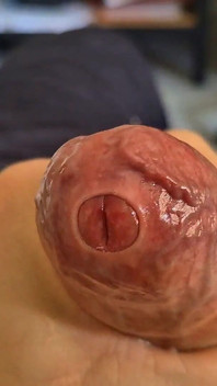 Phimosis Stepdaddy. Ight Foreskin Stroking Until I Leak Everywhere