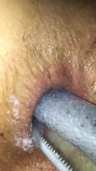Anal Insertion