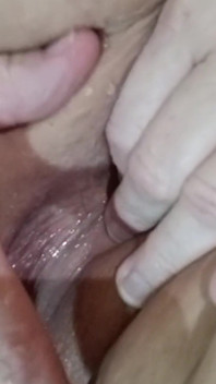 His Hands All in That Juicy Pussy She Squirts on Her Fupa He Licks It up Supadupa