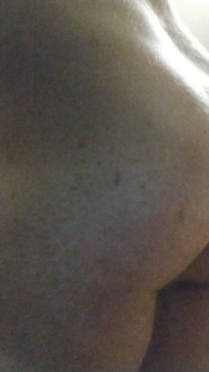 Permanently gaped: Đít bị kéo căng bởi mandarin orange