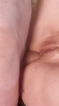 Anal Sex