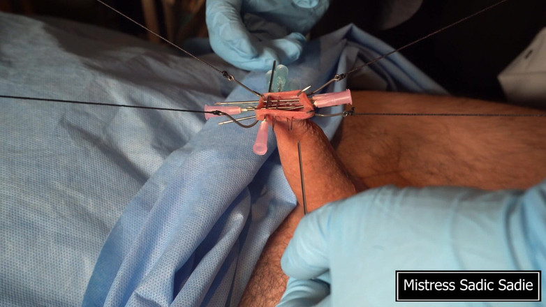 Sadic Sadie: 바늘 CBT의 최고입니다!