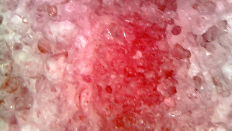 Nicoletta Embassi: Medical Endoscope Oral Exam: Gummy Chewing, Extreme Teeth &amp; Tongue Macro