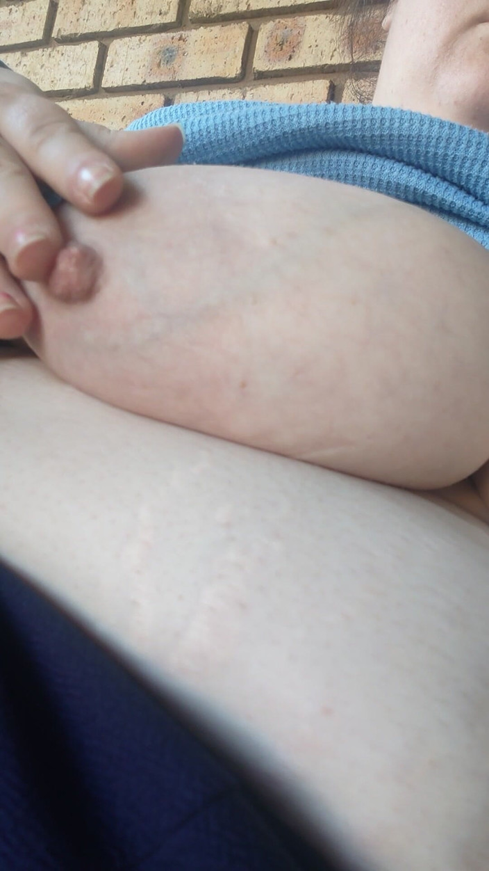 Aliceqii: Playing Outside with My Huge Titties