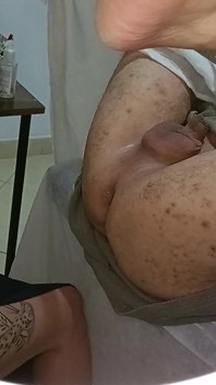 Der Patient macht eine Prostata-untersuchung, steckt aber am ende ein strapon in seinem arsch fest