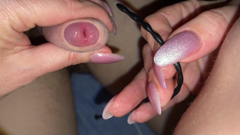 Hairy couple: Por primera vez, se introduce una sonda urogenital en el...