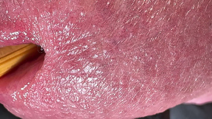 Leonardo-1974: L'acorno e il mio buco mi rendono felice