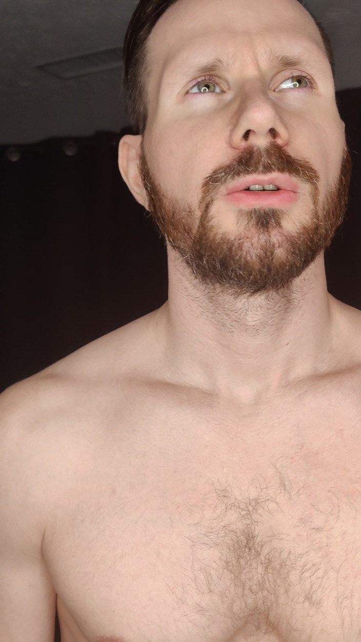 Albino Adonis: Bem-vindo