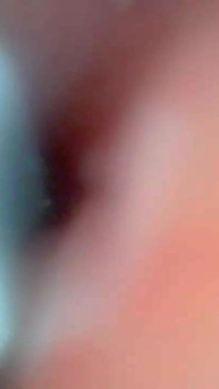 Endoskopische Kamera Nimmt Moment Der Männlichen Ejakulation Ein 4K