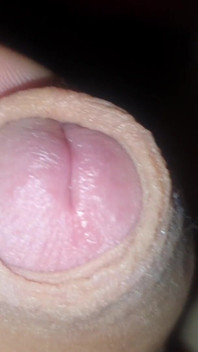 Dick Zoom