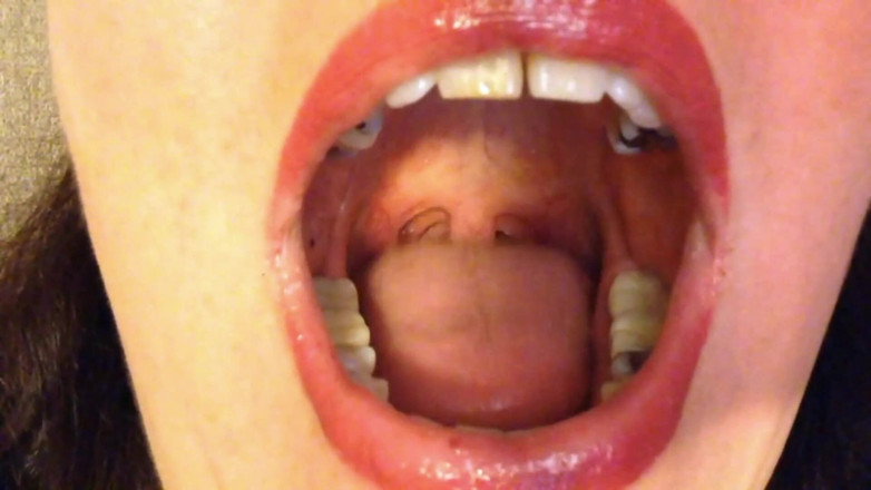 Lily Lipstixxx: Mouth inspection - Be careful, I bite!