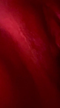 Vibrator
