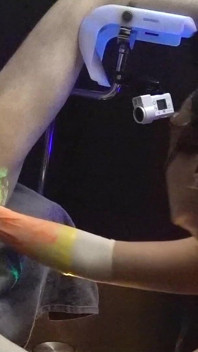 1st. Uv-neon Light Anal Fisting Experience of Adelina Noir and Fistdude