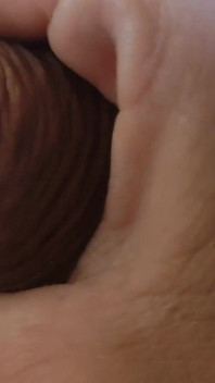Great Phimosis Getting in the Way of the Boy's Orgasm