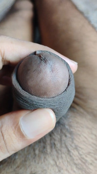 My Penis