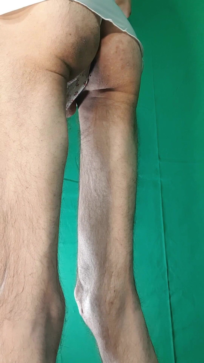 HeIsSooThin: Nightgown dan Flower-y Thong lancar