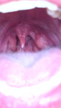 Fetiche de lengua