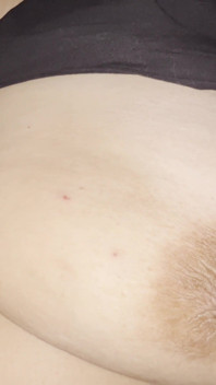 Nipple Montage 3