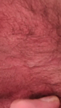 I Spread My Anal Opening.
