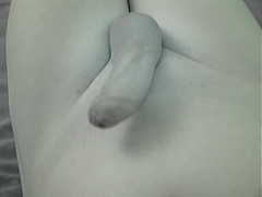 Wibblewang: Odstranění katétru