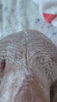 Rasatura infermiera dal buco del culo e scrotum