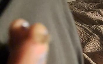 Peeling a Huge Toe Skin Flake