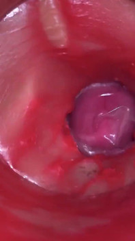 Camera Inside Pussy - Powerfull Cum in Pussy! Best Internal Asmr