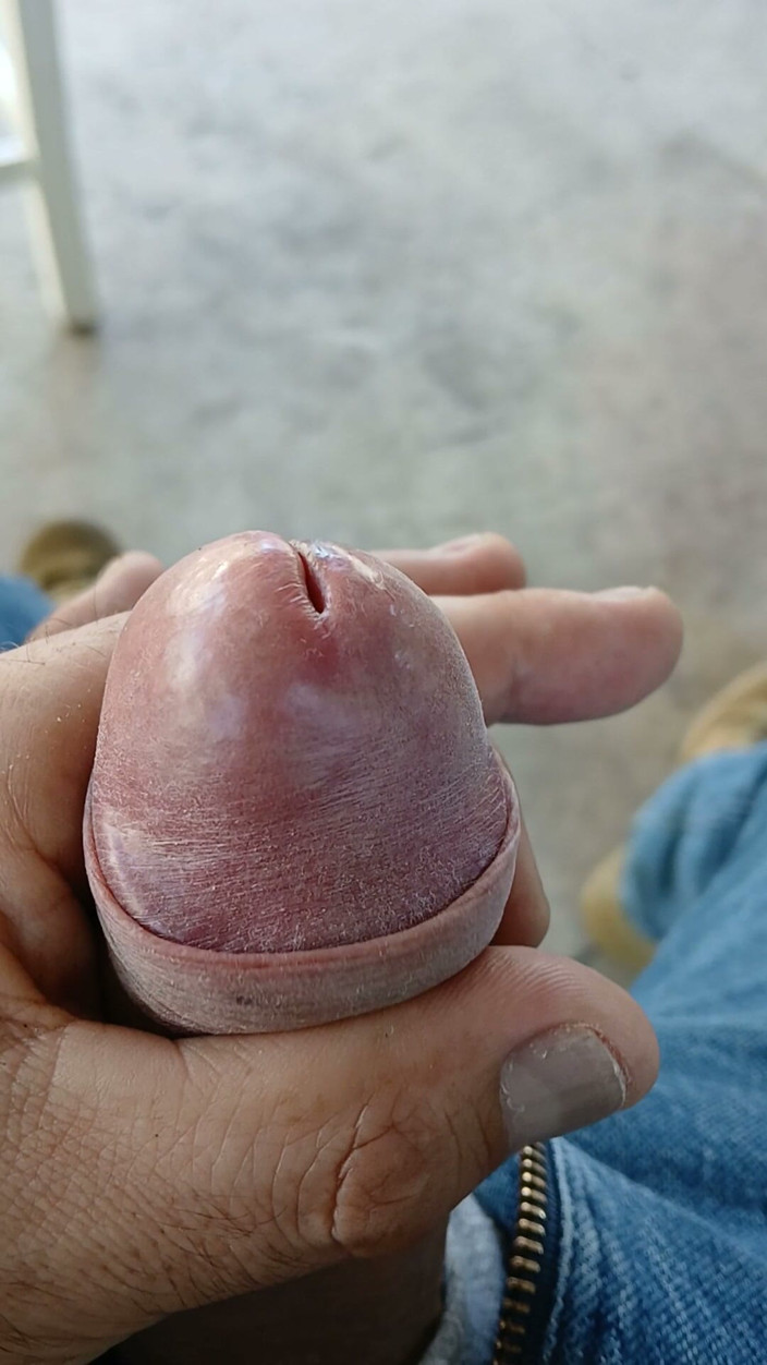 VERGA CON LUNAR: Big Dick and Precum