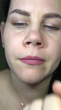 Anna muestra su nariz y estaba atada