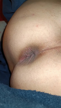 My Anus